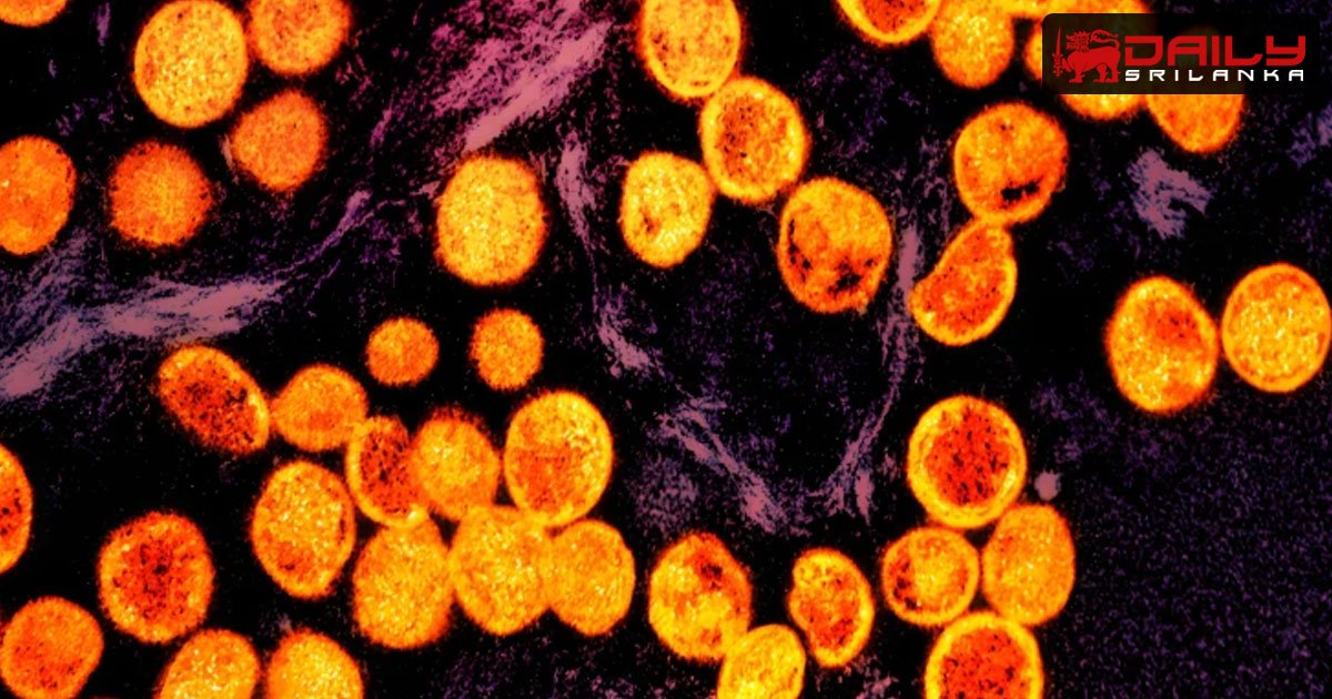 පළමු mpox ආසාධිතයා පාකිස්තානයෙන් වාර්තා වෙයි
